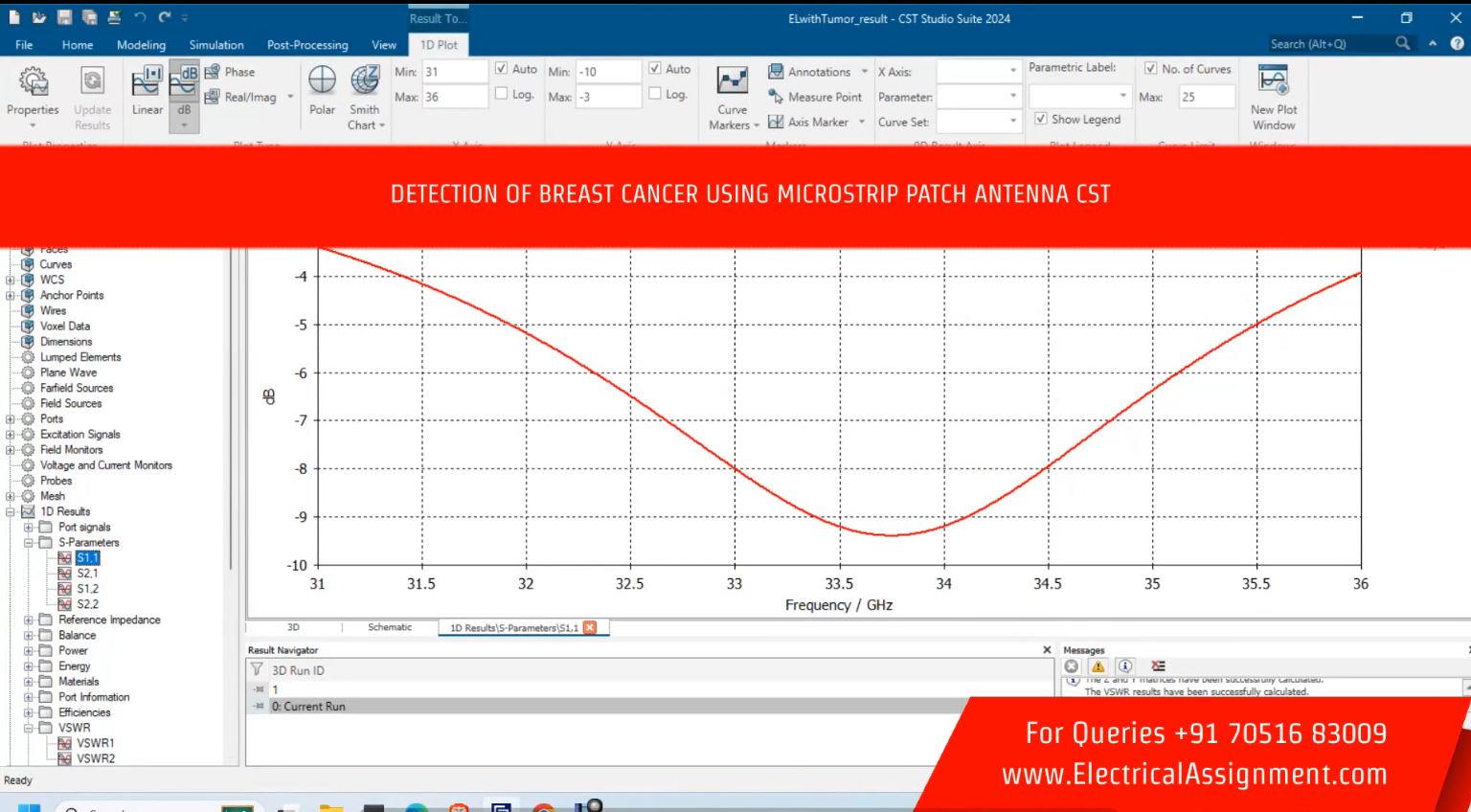 Design and implementation of flexible wearable antenna on thyroid gland in the detection of cancer cells screenshot 6